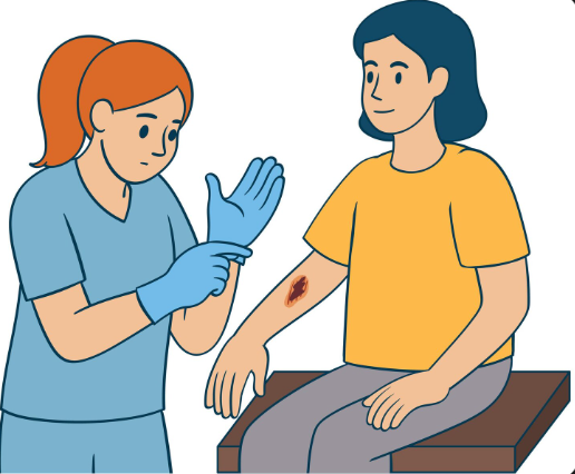Nursing Management of Burns